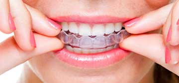 Dr. Joseph S. Levy - Invisalign