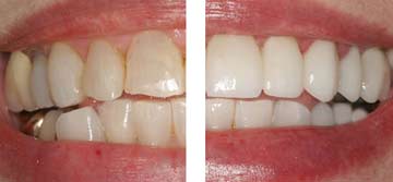 Dr. Joseph S. Levy - Cosmetic Restoration