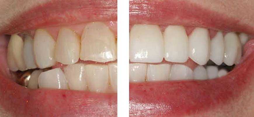 Dr. Joseph S. Levy: Cosmetic Restoration